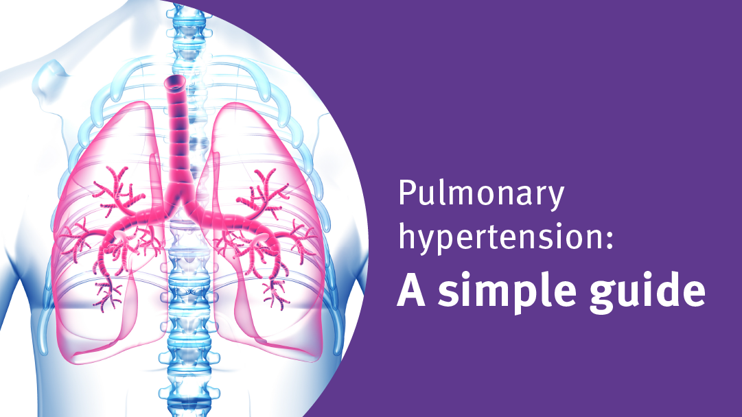 Pulmonary hypertension: A simple guide | Blog | ndd Medical